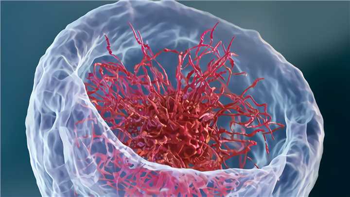 NASH biomarker